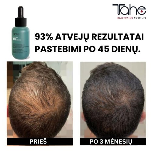 Plaukų slinkimą mažinantis ir augimą skatinantis koncentratas Peptide T98 TAHE, 50 ml - Image 5