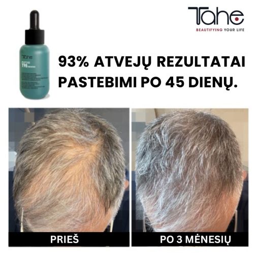 Plaukų slinkimą mažinantis ir augimą skatinantis koncentratas Peptide T98 TAHE, 50 ml - Image 4